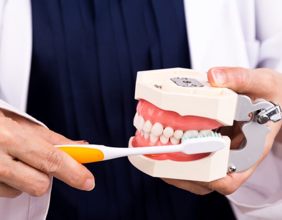 How to Care For Dental Implants